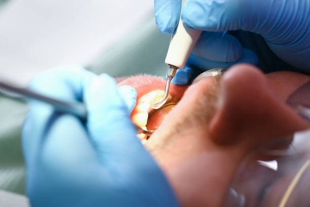Best Emergency Dental Surgery in Lewiston, MN