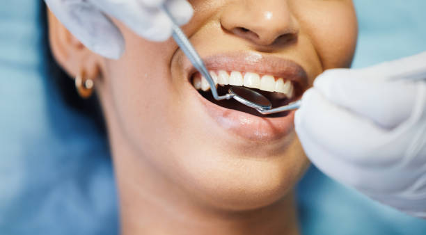 Best Emergency Tooth Extraction in Lewiston, MN